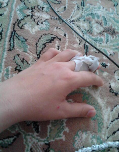 عکس دسته شکسته فیک