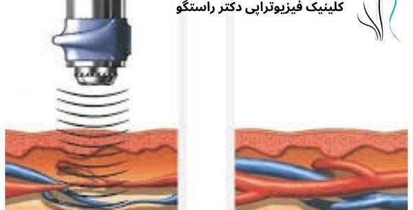 عکس سوتی های وسط رابطه نی نی سایت