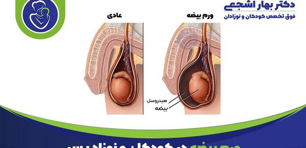 عکس سوتی های زیر نافی نی نی سایت