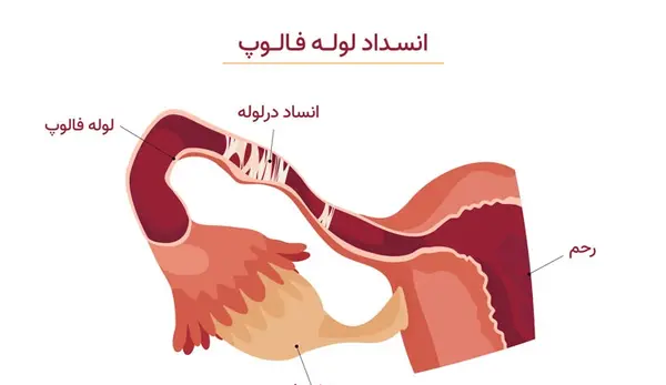 عکس سوتی امپول زدن نی نی سایت