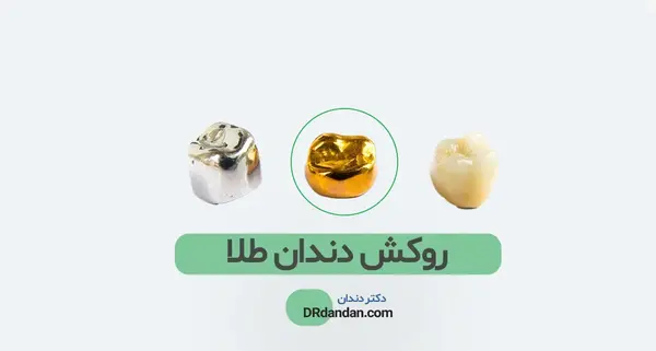 عکس فیلم دندون طلا