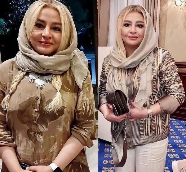 عکس بازیگران سریال زخم کاری فصل دوم