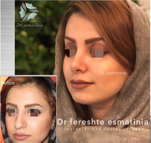 عکس دکتر فرشته علی حسینی نی نی سایت
