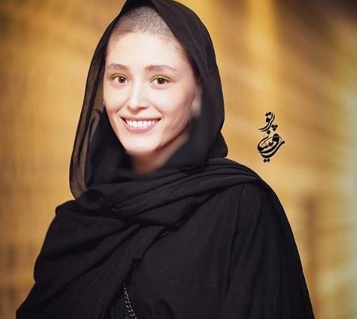 عکس کچلی فرشته حسینی
