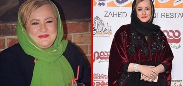 عکس جدید نعیمه نظام دوست بعد از عمل لاغری