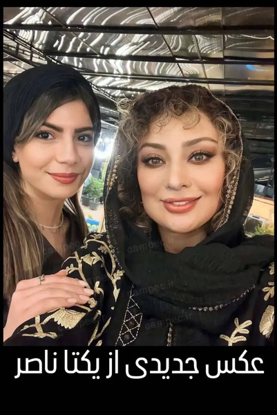 عکس جدید یکتا ناصر بعد از عمل زیبایی