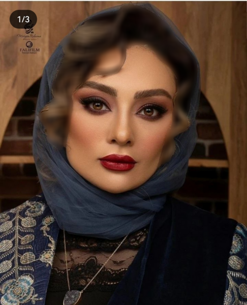 عکس جدید یکتا ناصر بعد از عمل زیبایی