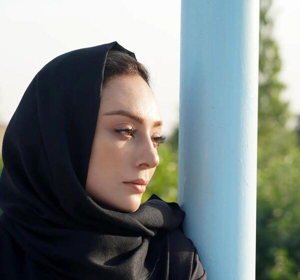 عکس جدید یکتا ناصر بعد از عمل زیبایی
