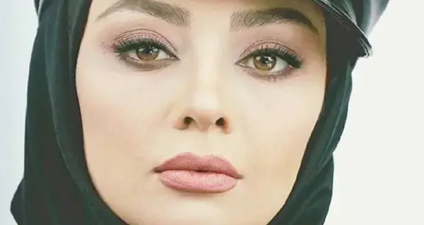 عکس جدید یکتا ناصر بعد از عمل زیبایی