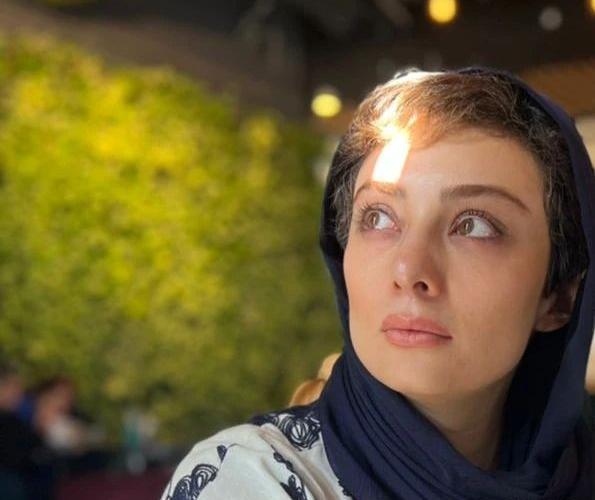 عکس جدید یکتا ناصر بعد از عمل زیبایی
