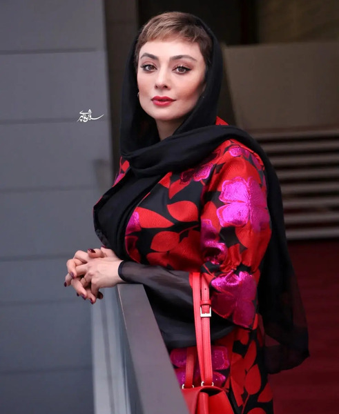 عکس جدید یکتا ناصر بعد از عمل زیبایی