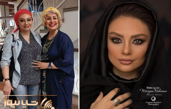 عکس جدید یکتا ناصر بعد از عمل زیبایی