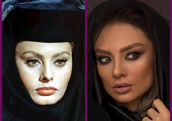 عکس جدید یکتا ناصر بعد از عمل زیبایی