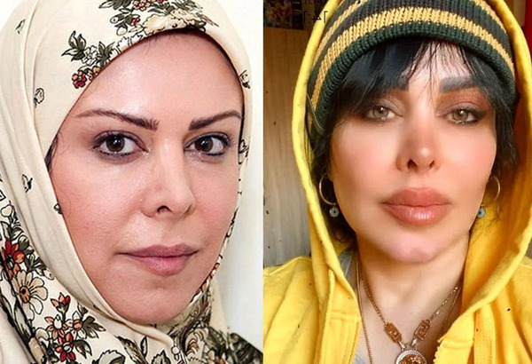 جدید ترین عکس فلور نظری