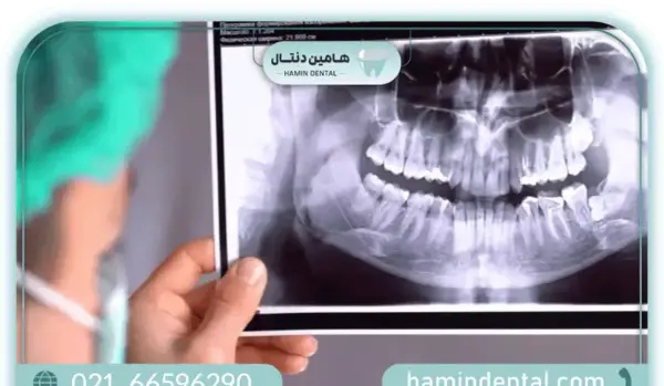 عکس های opg دندان