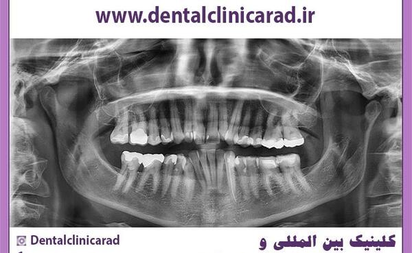 عکس های opg دندان