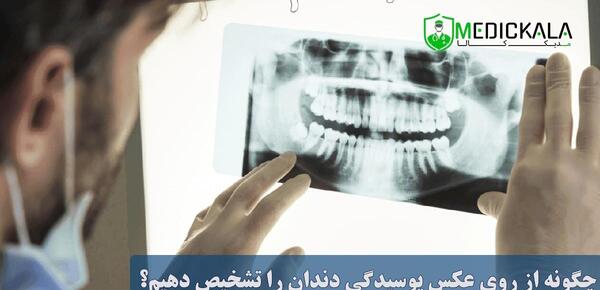 عکس های opg دندان