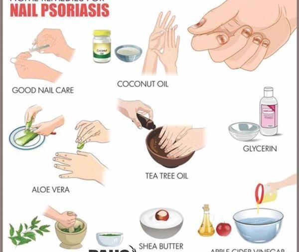 عکس بیماری صدف ناخن