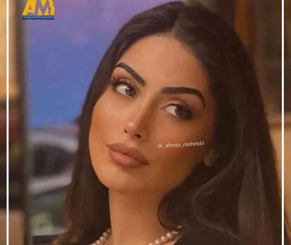 عکس های قبل عمل صدف بیوتی
