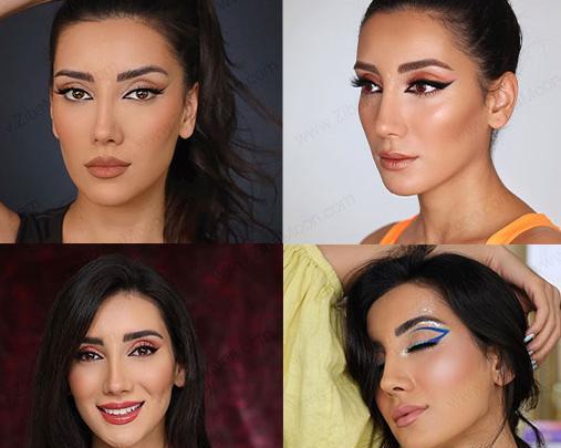 عکس قبل عمل صدف الماسی