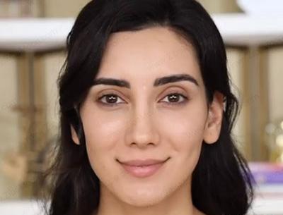 عکس قبل عمل صدف الماسی