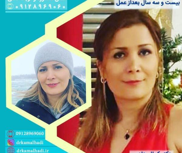 عکس عمل بینی صدف بیوتی