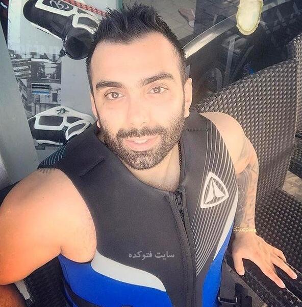 عکس مسعود صادقلو قبل از عمل بینی