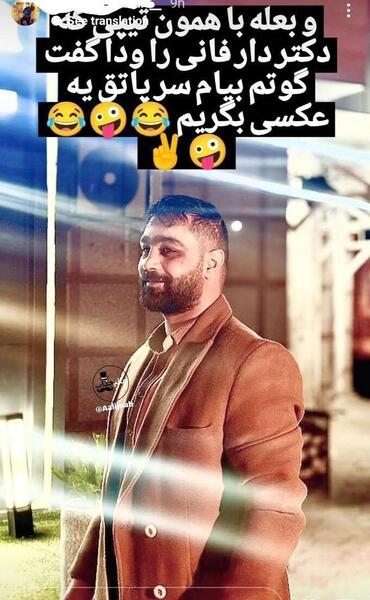 عکس مسعود صادقلو قبل از عمل بینی