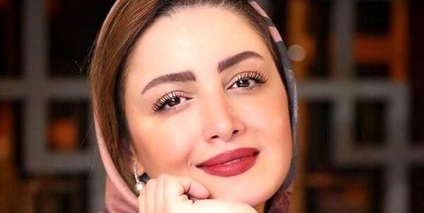 عکس مسعود صادقلو قبل از عمل بینی
