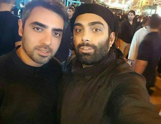 عکس مسعود صادقلو قبل از عمل بینی