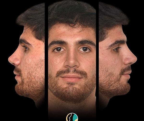 عکس قبل عمل نادیا صالحی