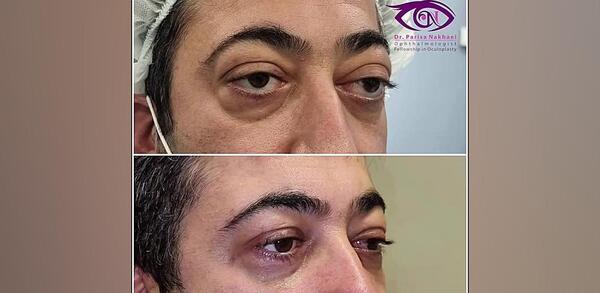 عکس قبل عمل نادیا صالحی