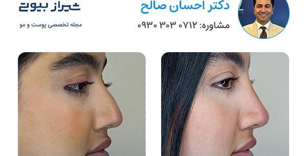 عکس قبل عمل نادیا صالحی