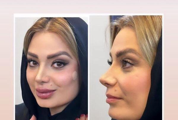 عکس های صبا راد بعد از مهاجرت