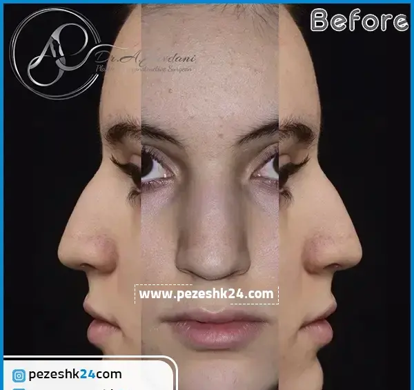 بلاگر عکس شکوفه و علیرضا رمضانی