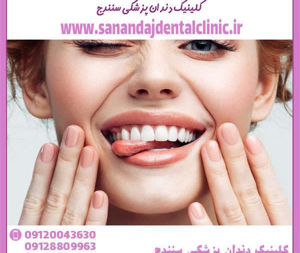 عکس جوش شیرین دندان