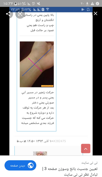 عکس جوش شیرین و ادرار