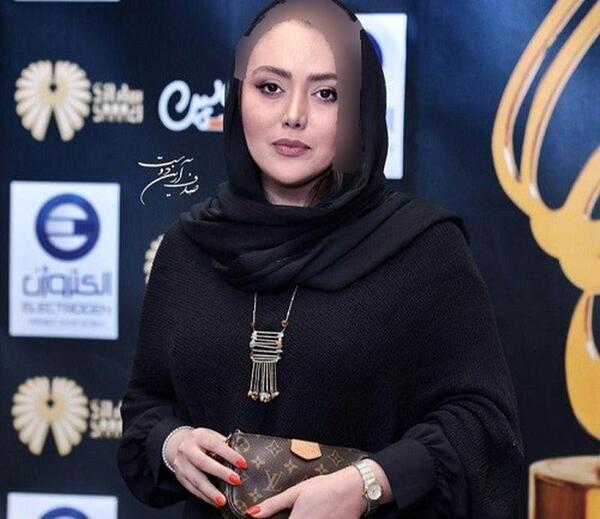 عکس شادی مختاری قبل از عمل
