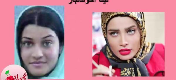 عکس شادی مختاری قبل از عمل
