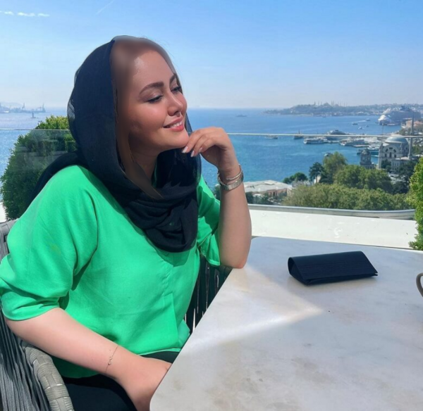 عکس شادی مختاری قبل از عمل زیبایی