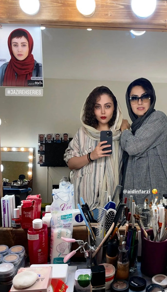 عکس شادی مختاری قبل از عمل زیبایی