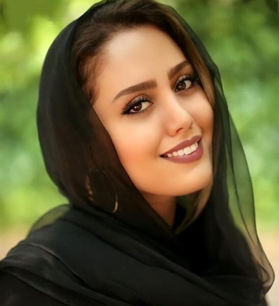 عکس شادی مختاری قبل از عمل زیبایی