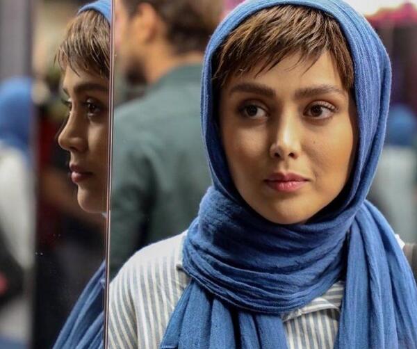 عکس شادی مختاری قبل از عمل زیبایی