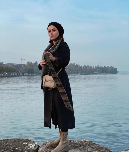 عکس شادی مختاری قبل از عمل زیبایی