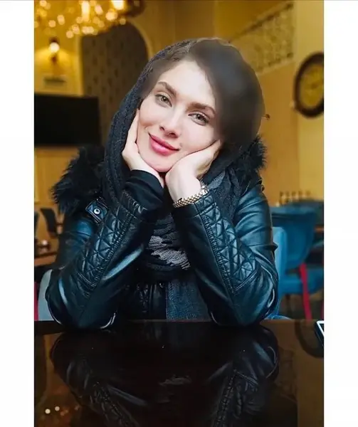 عکس قبل از عمل ساناز سعیدی
