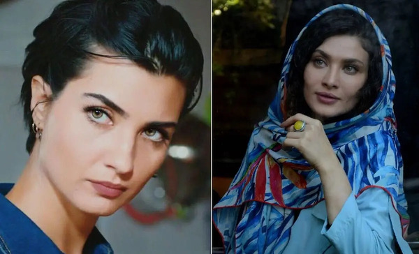 عکس قبل از عمل ساناز سعیدی