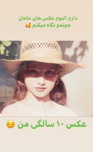 عکس قبل از عمل ساناز سعیدی