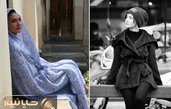 عکس قبل از عمل ساناز سعیدی