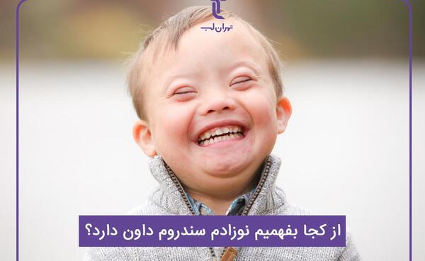 عکس ساناز ۱۷ ماهه نی نی سایت