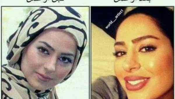 عکس سمانه پاکدل قبل و بعد از عمل